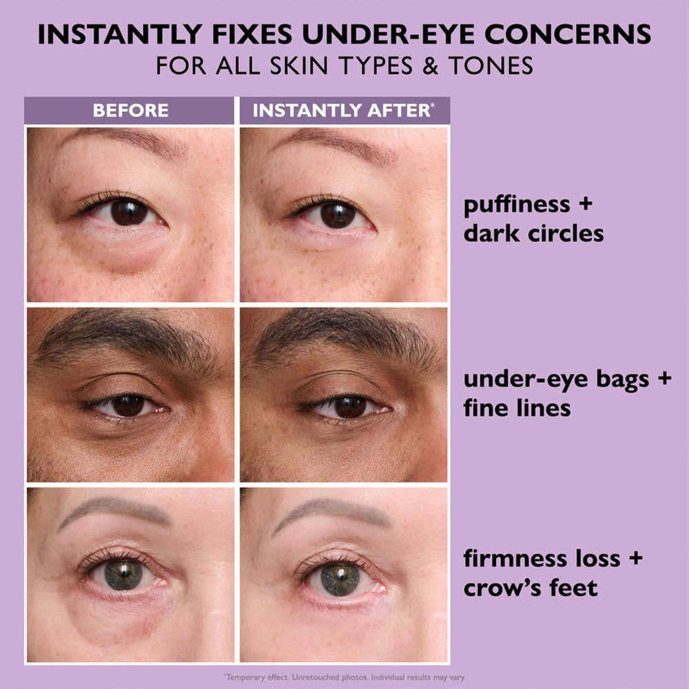 ✨Instant Wrinkle Eye Tightener Cream (FREE BONUS BRUSH)
