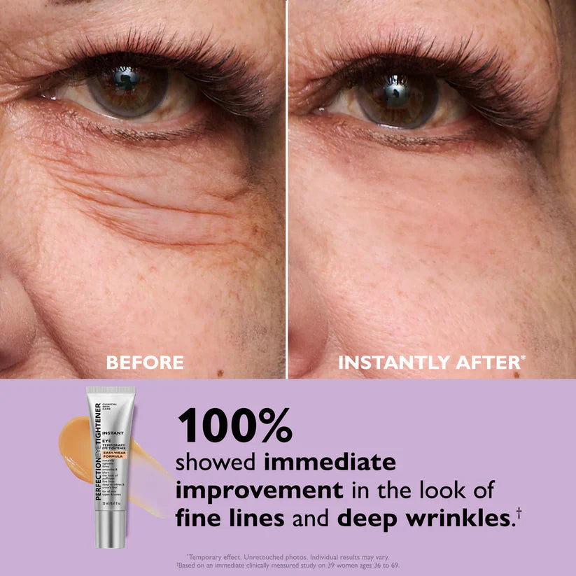 ✨Instant Wrinkle Eye Tightener Cream (FREE BONUS BRUSH)